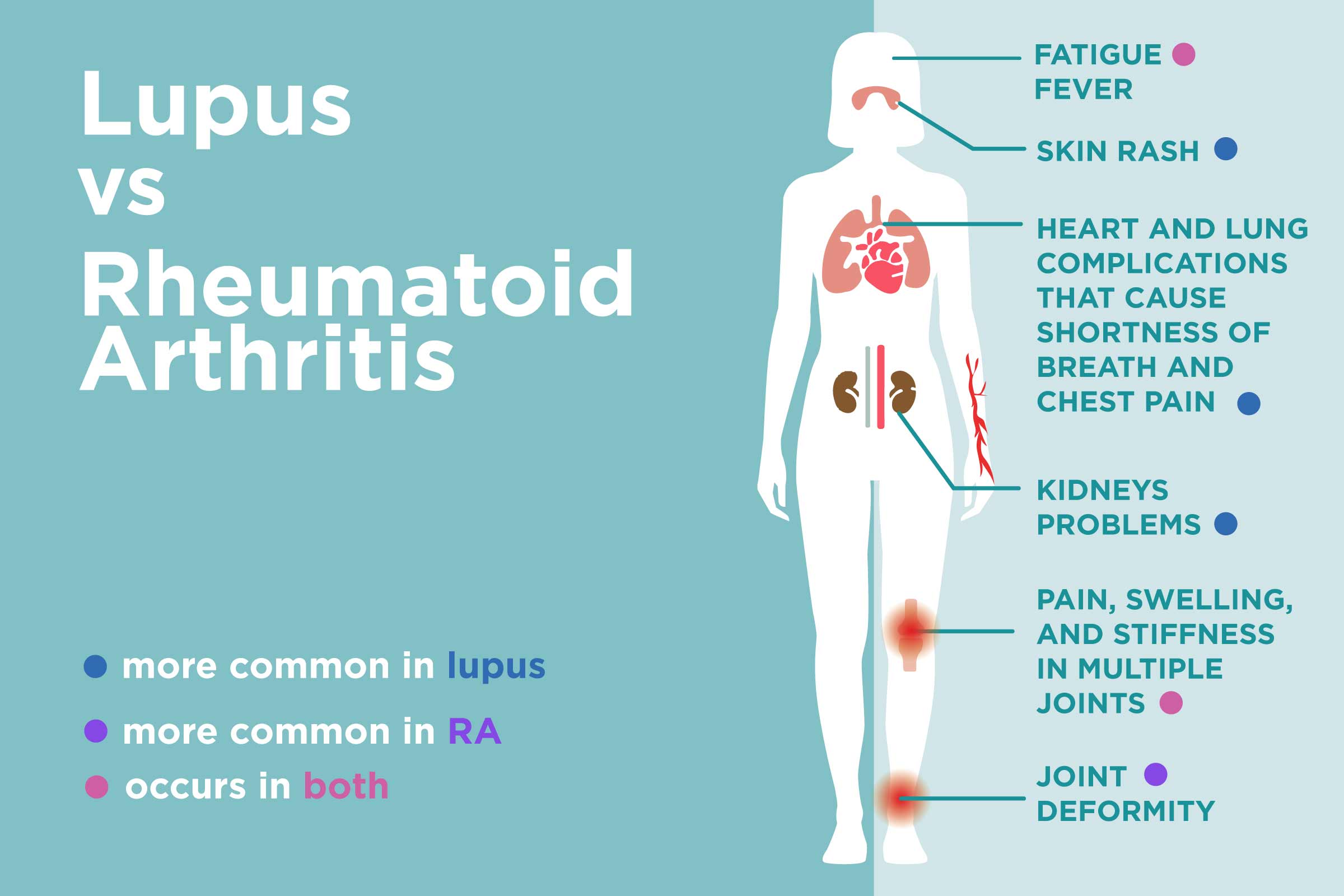 What is the difference between arthritis and rheumatoid ...