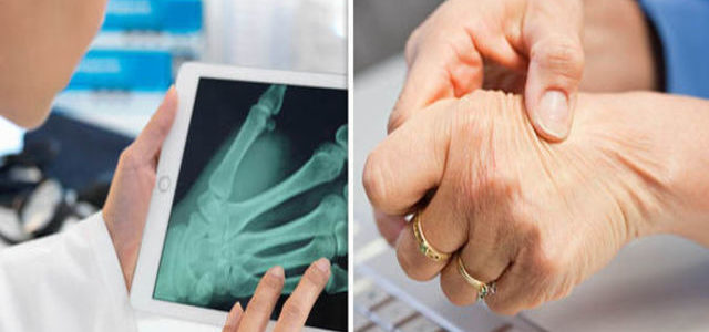 What Kind Of Doctor Treats Osteoarthritis