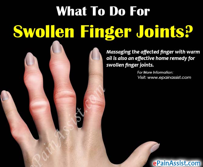 What To Do For Swollen Finger Joints?
