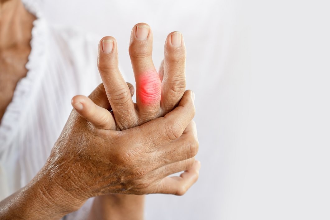 What to Do If You Have Arthritis Symptoms Such as Pain ...