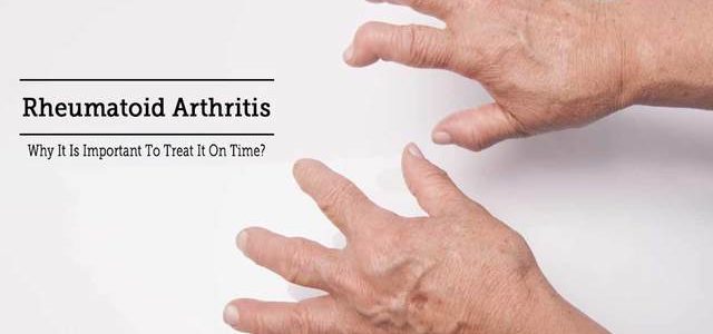 What Type Of Doctor Treats Rheumatoid Arthritis