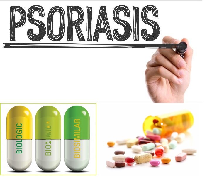 What You Need to Know about Psoriasis Biosimilar Treatments