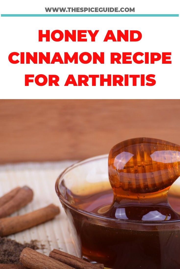 Whatever type of arthritis you are suffering from, honey and cinnamon ...