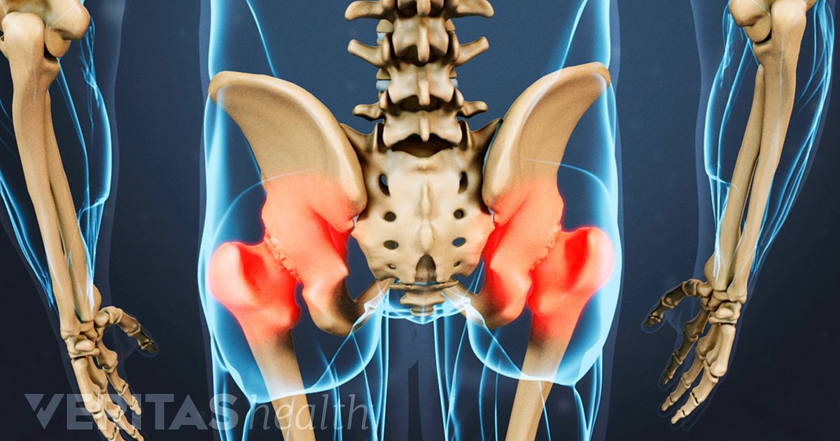 Whats Causing My Hip Pain?