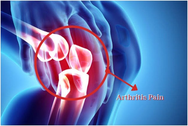 Whats Your Tag Blog Few ways to get rid of Arthritis pain ...