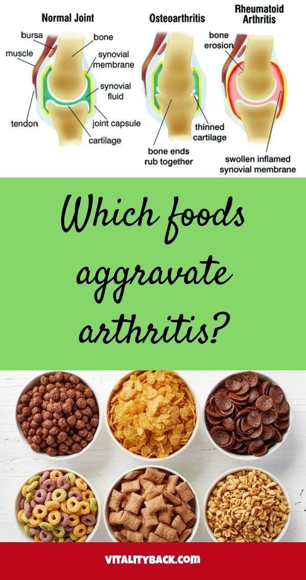 Which foods aggravate arthritis? Check the webpage to get ...