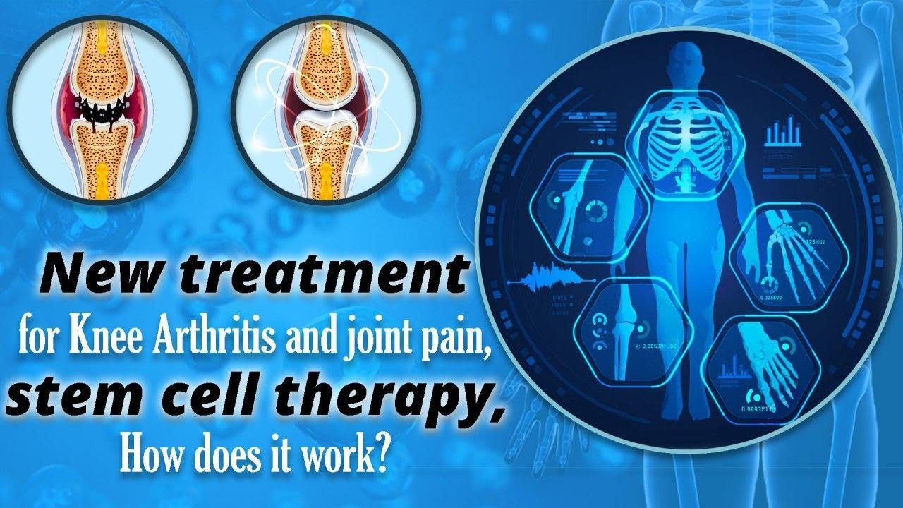 Why You Get Arthritis and How Stem Cell Therapy Can Fix It?
