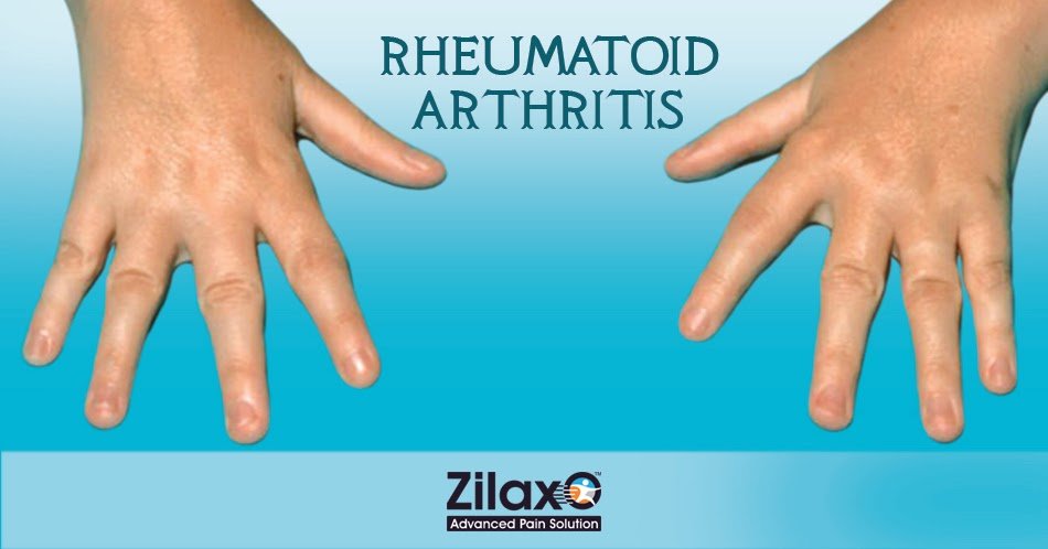 Zilaxo Advanced Pain Solution: Rheumatoid Arthritis